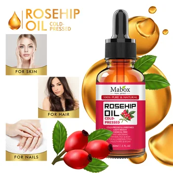 30Ml 100% Novo Óleo Essencial de Rosa melhorar a textura da pele de ar fresco reduzir a acne e o ponto da idade & mancha escura e massagem para relaxar o corpo